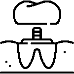 Prothèses dentaires